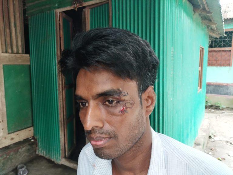 আড়াইহাজারে একরাতে ৩ বাড়ীতে ডাকাতি, টাকা ও মালামাল লুট আড়াইহাজারে ডাকাতদের হামলায় আহত ব্যক্তি